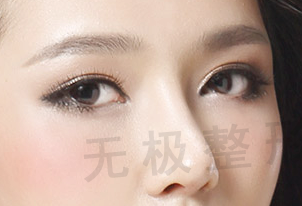 手术隆鼻要多少钱？广州隆鼻美容医院哪家专业?