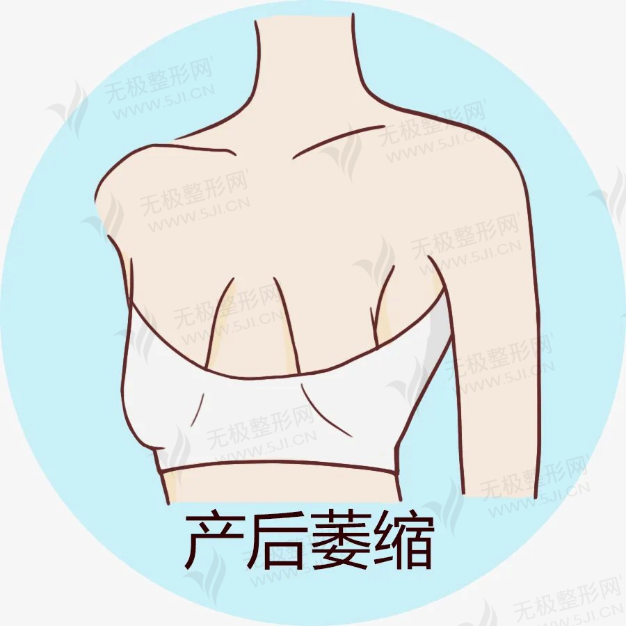 北京产后胸部整形医院排名前十榜单已公布！2022-07月最新整理！