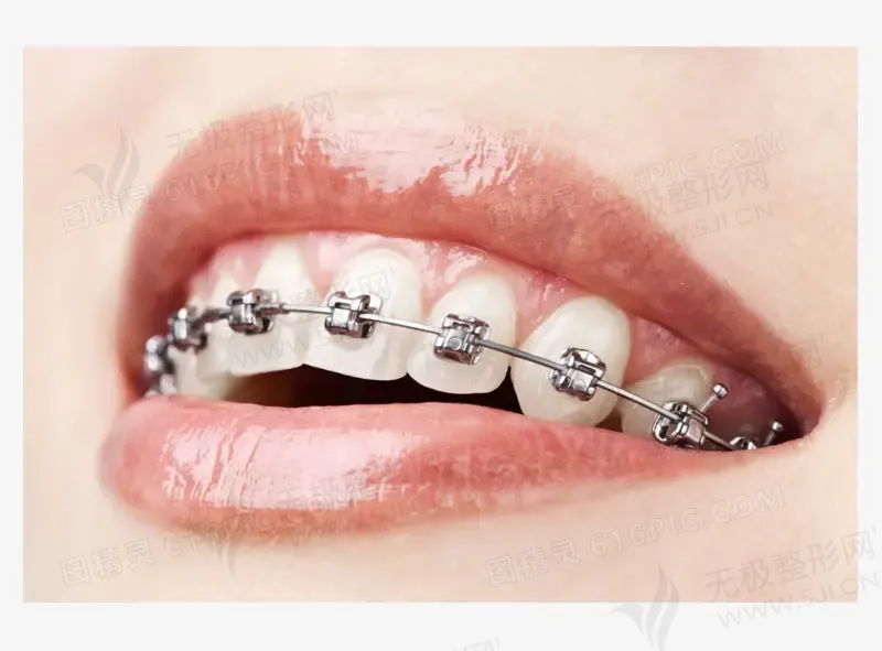 合肥牙齿矫正排名前四、前八的口腔医院有哪些？